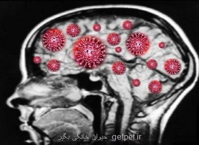 ریسک بالای سکته مغزی در بیماران کرونایی سالمند