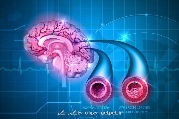 تاثیر استاتین در کاهش ریسک سکته در مبتلایان فیبریلاسیون دهلیزی