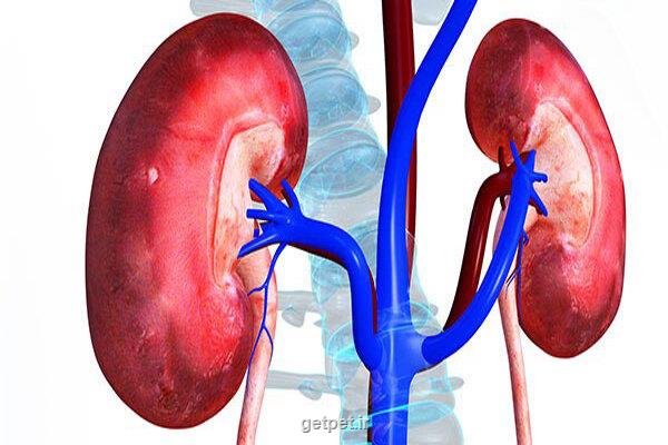 سنگ کلیه شایع ترین بیماری کلیوی در استان آذربایجان شرقی