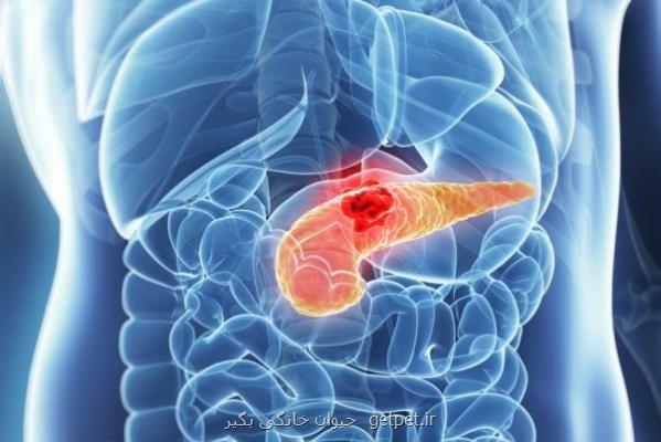 احتمال بقای ۵ ساله سرطان پانکراس افزایش پیدا کرد
