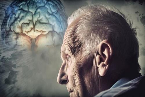 نتایج اعجاب انگیز یک مطالعه دارویی که از آلزایمر پیشگیری می کند