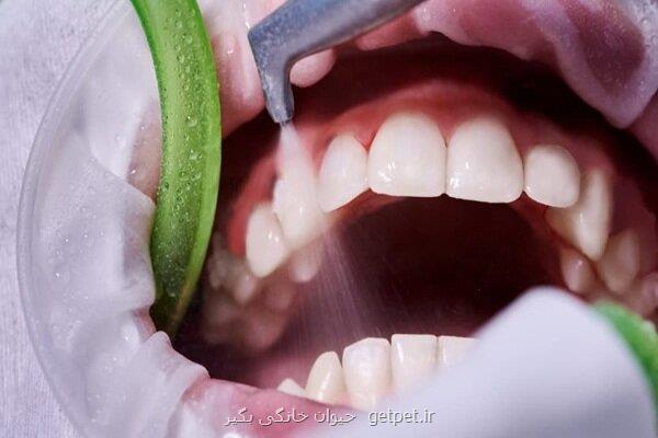 ضرورت سلامت دهان و جلوگیری از بیماری های لثه ای