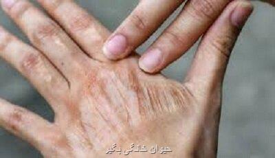 آیا کلاژن واقعا پوست را جوان می کنند؟