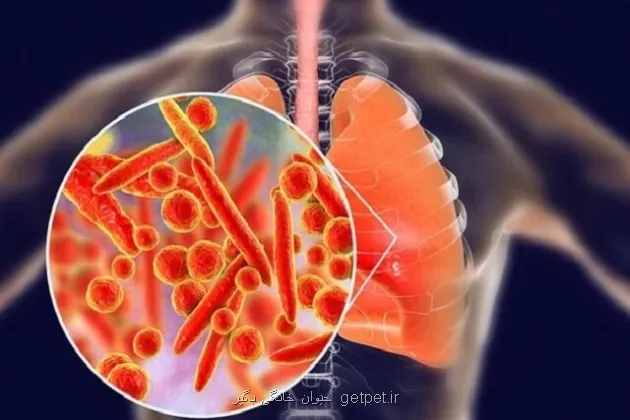 بیماری انسدادی مزمن ریه چهارمین علت مرگ ومیر جهان است