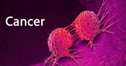 30 تا 50 درصد سرطان ها قابل پیشگیری است